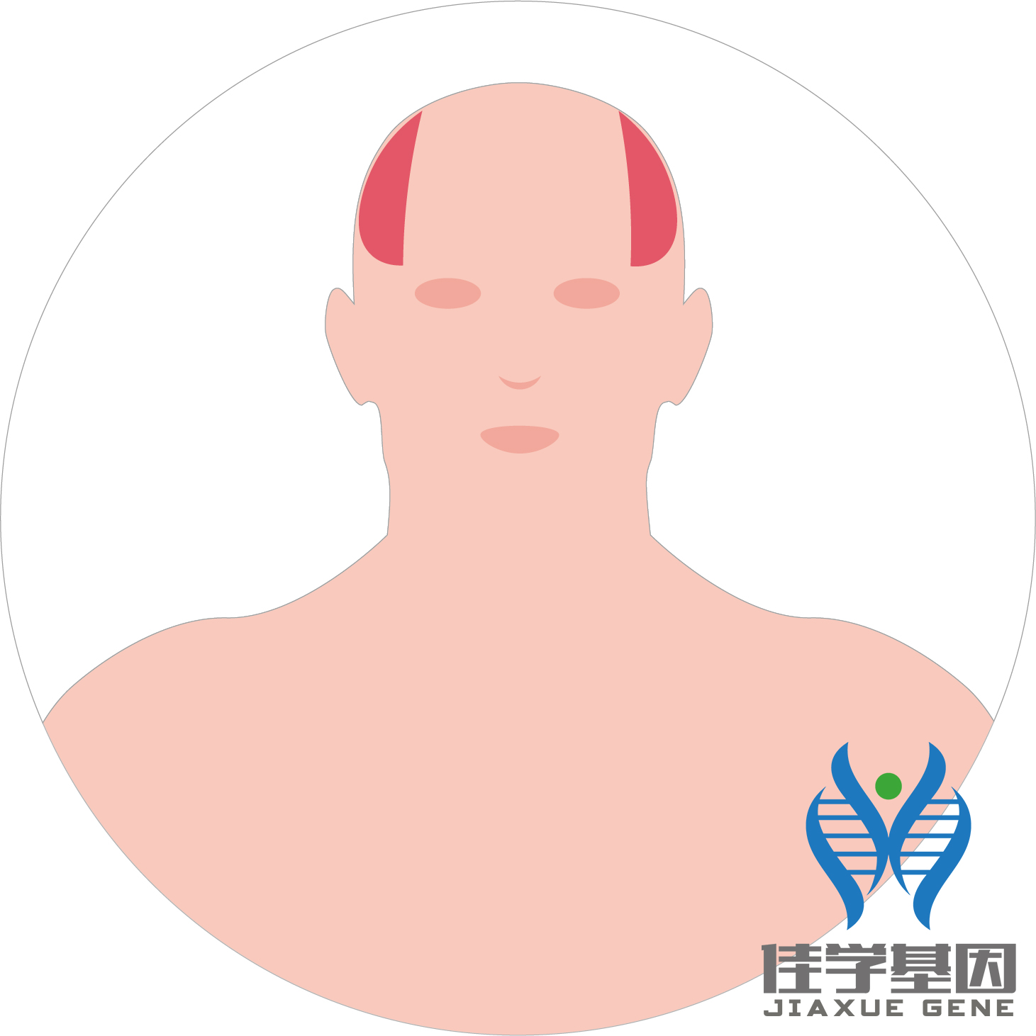 【佳學(xué)基因檢測】男性<font color='red'>脫發(fā)</font>（Androgenetic alopecia）基因解碼、<a href=http://deyicom.cn/tk/jiema/cexujishu/2021/31933.html>基因檢測</a>