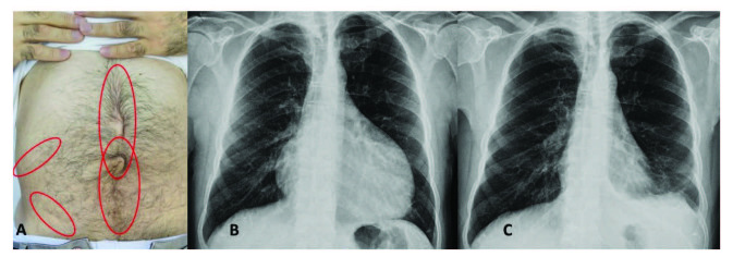 包含圖片、插圖等的外部文件。對(duì)象名稱為 turkjmedsci-50-1591-fig001.jpg